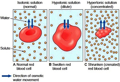 osmosis hypertonic hypotonic cells isotonic effect crenation solute osmotic tonicity shrinking concentration nurse flows